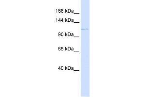 PTCH2 antibody used at 1 ug/ml to detect target protein.