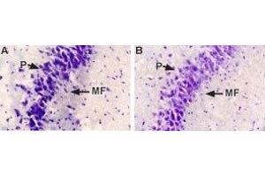 Expression of NGF in rat brain - Immunohistochemical staining of rat hippocampal mossy fiber terminal zone using Anti-NGF Antibody (#AN-240). (Nerve Growth Factor antibody  (Intracellular))