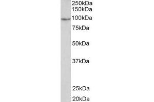 ABIN5539878 2µg/ml) staining of Human Uterus lysate (35µg protein in RIPA buffer).