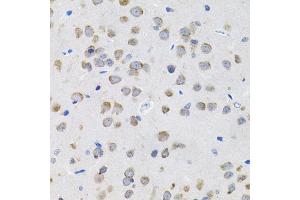 Immunohistochemistry (IHC) image for anti-Interleukin 13 (IL13) (AA 25-146) antibody (ABIN3022882)