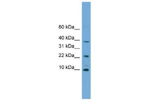 WB Suggested Anti-CHCHD8 Antibody Titration: 0. (COA4 antibody  (Middle Region))