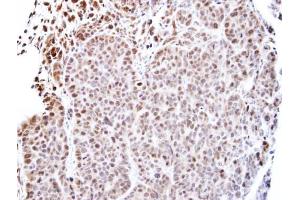 IHC-P Image Immunohistochemical analysis of paraffin-embedded SW480 xenograft, using TEAD4, antibody at 1:500 dilution. (TEAD4 antibody  (Center))