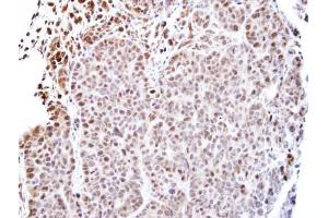 IHC-P Image Immunohistochemical analysis of paraffin-embedded SW480 xenograft, using TEAD4, antibody at 1:500 dilution.