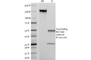 SDS-PAGE Analysis Purified Macrophage L1 Protein Mouse Monoclonal Antibody (MAC387). (S100A8 antibody)