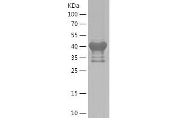 EML1 Protein (AA 1-183) (His-IF2DI Tag)