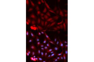 Immunofluorescence (IF) image for anti-Proteasome (Prosome, Macropain) Activator Subunit 1 (PA28 Alpha) (PSME1) antibody (ABIN1876546) (PSME1 antibody)