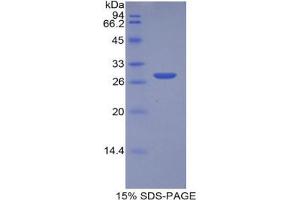 SDS-PAGE analysis of Human MPST Protein. (MPST Protein)