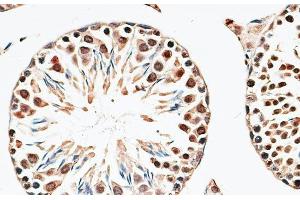 Immunohistochemistry of paraffin-embedded Mouse testis using CBX6 Polyclonal Antibody at dilution of 1:100 (40x lens). (CBX6 antibody)