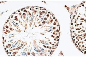 Immunohistochemistry of paraffin-embedded Mouse testis using CBX6 Polyclonal Antibody at dilution of 1:100 (40x lens).