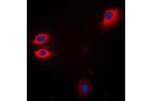 Immunofluorescent analysis of JAK1 staining in Jurkat cells.