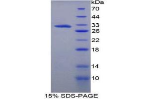 SDS-PAGE (SDS) image for Versican (Vcan) (AA 3058-3299) protein (His tag) (ABIN2127222)