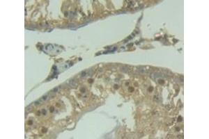 Figure. (AIM2 antibody  (AA 1-343))