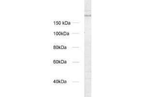 dilution: 1 : 1000, sample: crude synaptosomal fraction of rat brain (P2) (UNC13A/Munc13-1 antibody  (AA 3-317))
