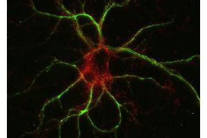 Indirect immunostaining of PFA fixed rat hippocampus neurons with anti-M6a glycoprotein (dilution 1 : 500; red) and mouse anti-MAP 2 (cat. (GPM6A antibody)