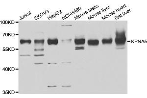 Western blot analysis of extracts of various cell lines, using KPNA5 antibody (ABIN4904175) at 1:1000 dilution.