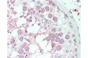 Human Testis: Formalin-Fixed, Paraffin-Embedded (FFPE) (AIP antibody  (Internal Region))