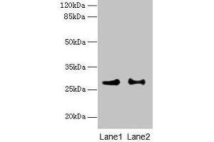 Western blot All lanes: HACD2 antibody at 4 μg/mL Lane 1: MCF-7 whole cell lysate Lane 2: LO2 whole cell lysate Secondary Goat polyclonal to rabbit IgG at 1/10000 dilution Predicted band size: 29 kDa Observed band size: 29 kDa (PTPLB antibody  (AA 7-41))