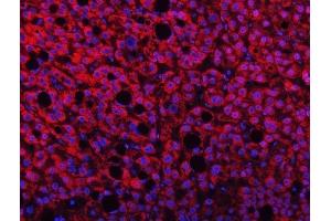 IF analysis of TMPRSS13 using anti-TMPRSS13 antibody (ABIN7599797). (TMPRSS13 antibody  (AA 118-572))