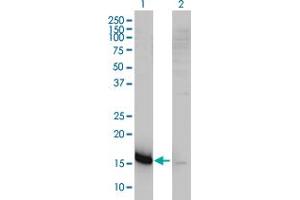 Western Blot analysis of CMTM5 expression in transfected 293T cell line by CKLFSF5 monoclonal antibody (M01), clone 2G1-6B10. (CMTM5 antibody  (AA 1-156))