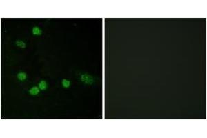 Immunofluorescence analysis of HeLa cells, using C-RAF (Ab-621) Antibody.