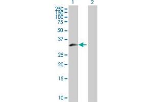 Western Blot analysis of ZNF215 expression in transfected 293T cell line by ZNF215 MaxPab polyclonal antibody.
