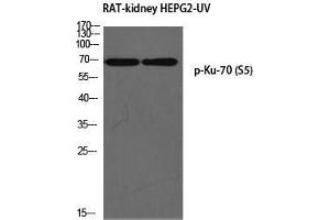 Western Blot (WB) analysis of Rat Kidney HepG2-UV using p-Ku-70 (S5) antibody. (XRCC6 antibody  (pSer5))