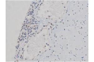 Immunohistochemistry (IHC) image for anti-Ribosomal Protein S6 Kinase, 70kDa, Polypeptide 1 (RPS6KB1) (pThr229) antibody (ABIN6255636)
