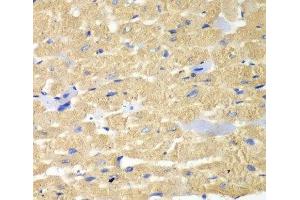 Immunohistochemistry of paraffin-embedded Mouse heart using HAX1 Polyclonal Antibody at dilution of 1:100 (40x lens). (HAX1 antibody)