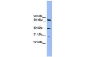 Image no. 1 for anti-Regulatory Factor X-Associated Protein (RFXAP) (AA 51-100) antibody (ABIN6744621) (RFXAP antibody  (AA 51-100))