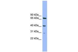 Image no. 1 for anti-Regulatory Factor X-Associated Protein (RFXAP) (AA 51-100) antibody (ABIN6744621)