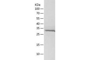 Western Blotting (WB) image for Myogenic Differentiation 1 (MYOD1) (AA 2-320) protein (His tag) (ABIN7124048) (MYOD1 Protein (AA 2-320) (His tag))