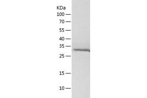 MYOD1 Protein (AA 2-320) (His tag)