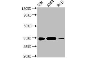 Western Blot Positive WB detected in: CEM whole cell lysate, K562 whole cell lysate, Raji whole cell lysate All lanes: CTLA4 antibody at 1:1000 Secondary Goat polyclonal to mouse IgG at 1/50000 dilution Predicted band size: 25, 7, 9, 20 KDa Observed band size: 34 KDa Exposure time:5 min (CTLA4 antibody  (AA 37-162))