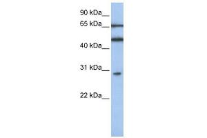 IFIT5 antibody used at 1 ug/ml to detect target protein. (IFIT5 antibody  (N-Term))