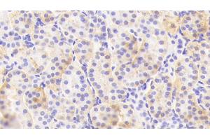 Detection of CHRNa4 in Human Kidney Tissue using Polyclonal Antibody to Cholinergic Receptor, Nicotinic, Alpha 4 (CHRNa4) (CHRNA4 antibody  (AA 49-242))