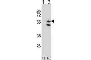 Western blot analysis of TUFM (arrow) using rabbit polyclonal TUFM Antibody (C-term) . (TUFM antibody  (C-Term))