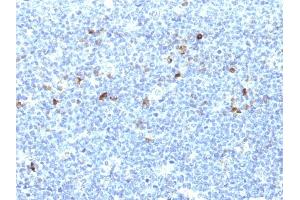 Formalin-fixed, paraffin-embedded human Tonsil stained with MHC I Monoclonal Antibody (CATA-1). (HLA-A antibody)
