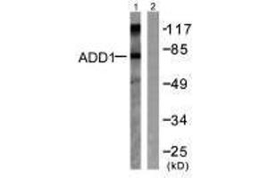 Western blot analysis of extracts from Hela cells treated with Forskolin (40nM, 30 min), using ADD1 (Ab-726) antibody. (alpha Adducin antibody  (Ser726))