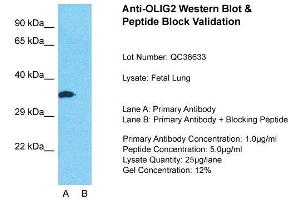 Host: Rabbit  Target Name: OLIG2  Sample Tissue: Fetal LungLane A:  Primary Antibody Lane B:  Primary Antibody + Blocking Peptide Primary Antibody Concentration: 1 µg/mL Peptide Concentration: 5 µg/mL Lysate Quantity: 41 µg/laneGel Concentration:. (OLIG2 antibody  (C-Term))