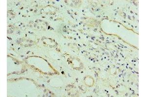 Immunohistochemistry of paraffin-embedded human kidney tissue using ABIN7143802 at dilution of 1:100 (ST8SIA2 antibody  (AA 24-160))
