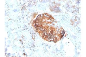 Formalin-fixed, paraffin-embedded human Kidney stained with MTAP Recombinant Mouse Monoclonal Antibody (rMTAP/1813). (Recombinant MTAP antibody  (AA 97-196))