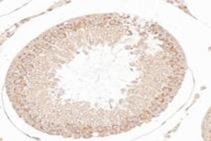 Immunohistochemistry analysis of paraffin-embedded rat testis using,NCKAP1 (ABIN7074784) at dilution of 1: 8000 (NCKAP1 antibody)