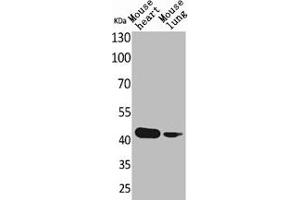 Western Blot analysis of mouse heart mouse lung cells using Actin-α cardiac muscle Polyclonal Antibody (ACTC1 antibody  (N-Term))