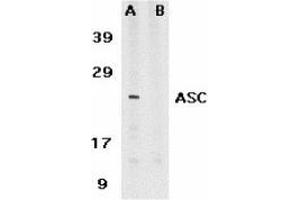 Western blot analysis of ASC in HL60 whole cell lysate in the absence (A) or presence (B) of blocking peptide with AP30084PU-N ASC antibody at 1 μg /ml. (PYCARD antibody)