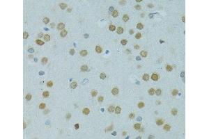 Immunohistochemistry of paraffin-embedded Rat brain using MUS81 Polyclonal Antibody at dilution of 1:100 (40x lens).