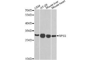 Western blot analysis of extracts of various cell lines, using RPS3 antibody (ABIN6290898) at 1:1000 dilution.