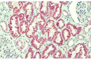 Human Kidney: Formalin-Fixed, Paraffin-Embedded (FFPE) (ANTXR2 antibody  (AA 121-133))