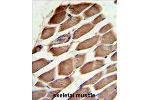 Formalin-fixed and paraffin-embedded human skeletal muscle reacted with ACTR3 Antibody , which was peroxidase-conjugated to the secondary antibody, followed by DAB staining.