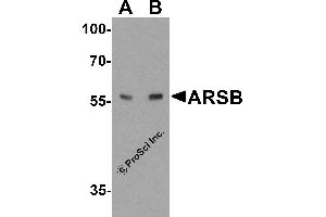 Western Blotting (WB) image for anti-Arylsulfatase B (ARSB) (C-Term) antibody (ABIN2457880)