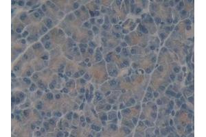 Immunohistochemistry (IHC) image for anti-Talin 1 (TLN1) (AA 975-1181) antibody (ABIN7442630)